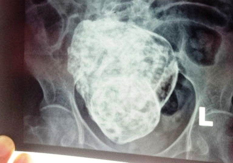 Hoi chan lien vien ca cu ba mang thai da hinh anh