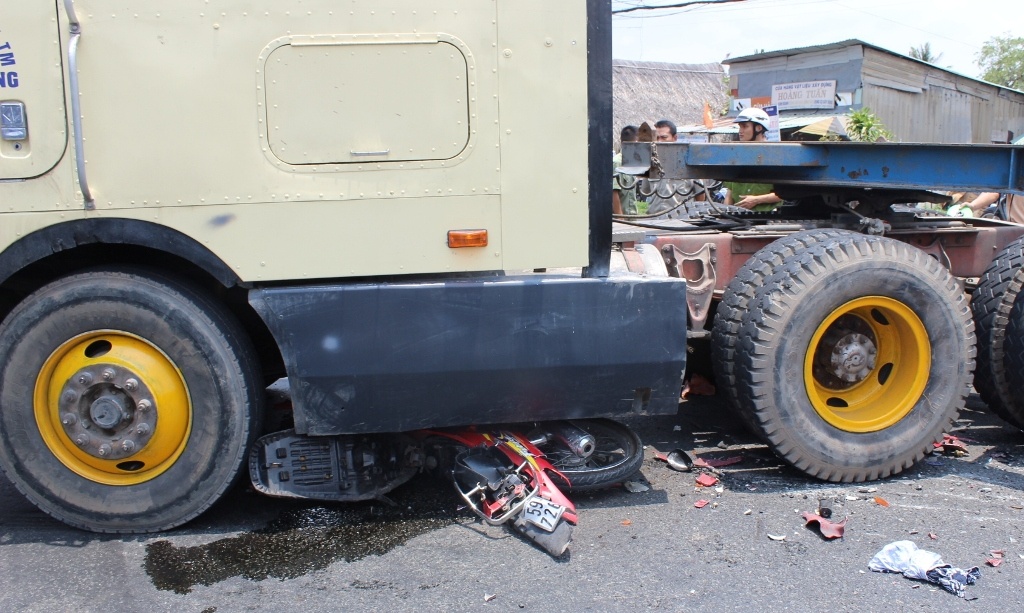 Nguoi dan giai cuu thanh nien bi xe dau keo can nat 2 chan hinh anh