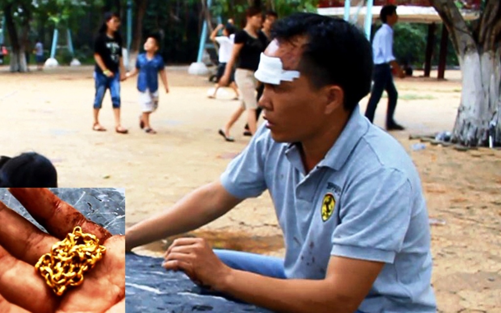 Anh Thời bị thương ở phần trán (ảnh lớn) cùng một đoạn của sợi dây chuyền bị đứt rơi lại (ảnh nhỏ).