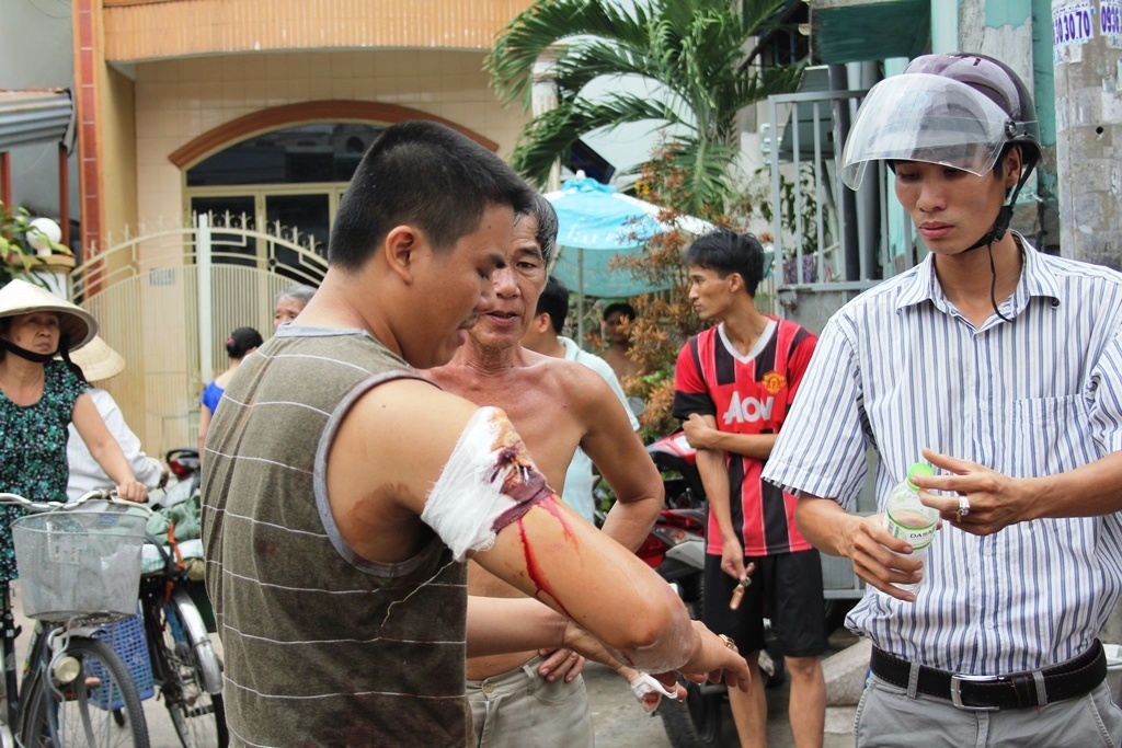 Thấy chị Trinh bị đốt, anh Tùng đang ở trong nhà lao ra dập lửa thì bị Nam rút dao truy sát khiến anh bị thương.