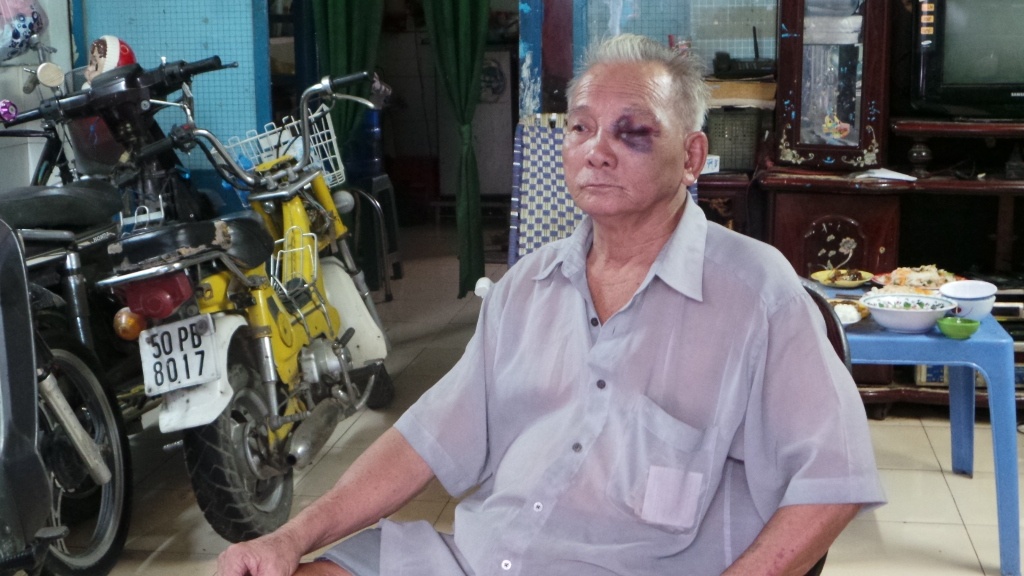 Cụ ông Lê Văn Đông bị nhóm côn đồ tấn công ngày 21/6 vì lên tiếng can thiệp hành động quậy phá.