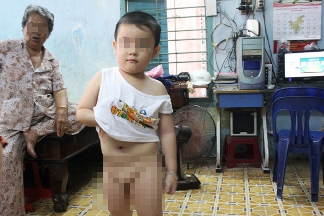 Bé Q. sau khi xuất viện về nhà.