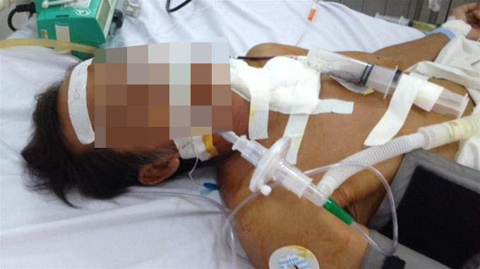 Thung thuc quan vi dung dua day nem mac nghen hinh anh