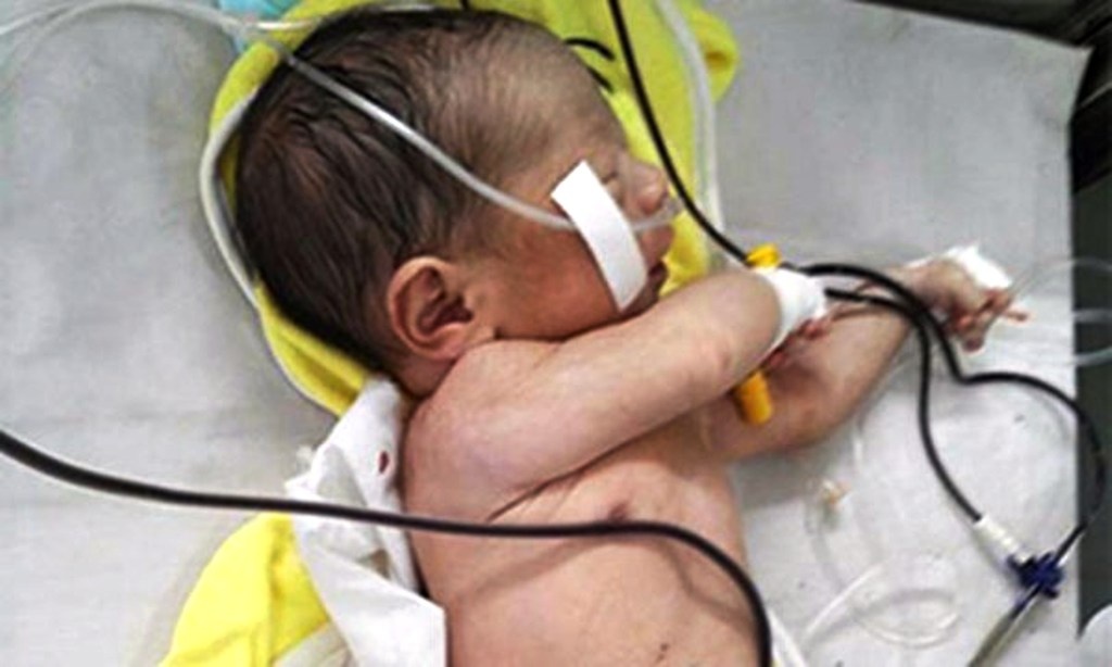 Noi dau phia sau vu tai nan khien thai nhi vang khoi bung me hinh anh