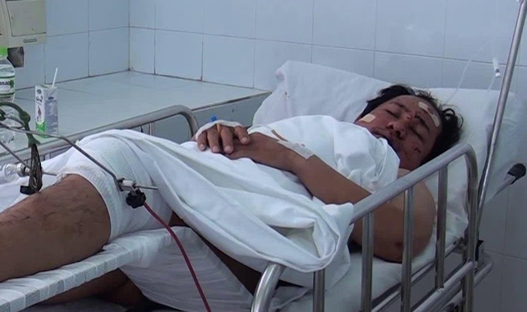 4 nguoi trong xe khach doi dau vang xuong duong hinh anh