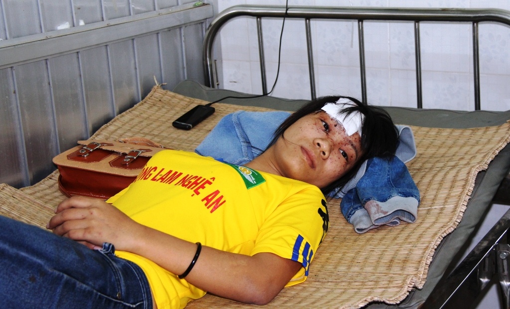 Nự công nhân Dương Thị Hồng Nhung đang nằm điều trị tại bệnh viện Hàm Thuận Nam.