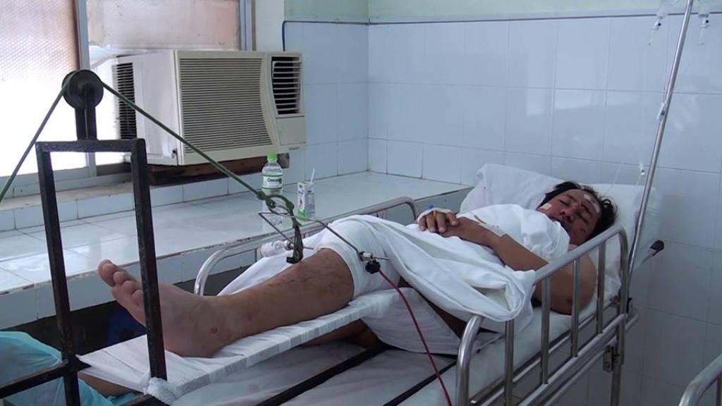 Tài xế Lê Văn Thanh đang nằm điều trị tại bệnh viện thành phố Phan Thiết.