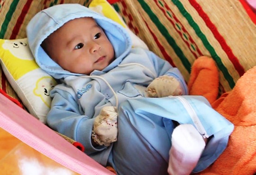 Huy vẫn kháu khỉnh dù chỉ có một chân.