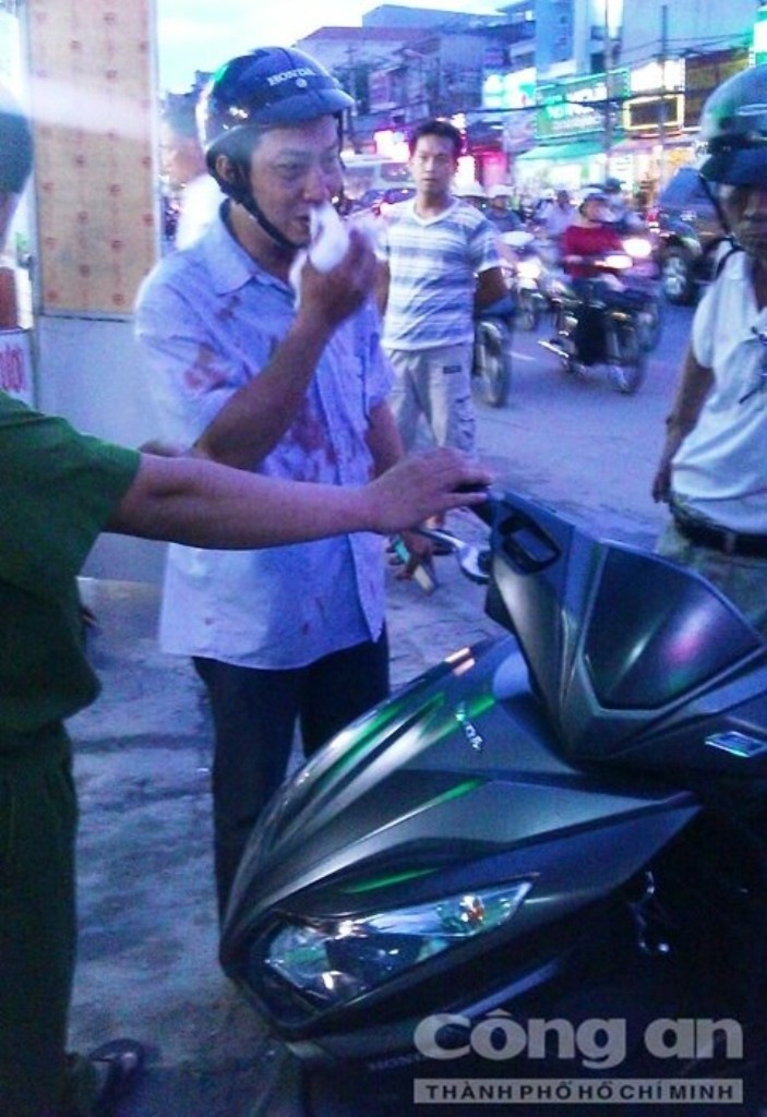 Anh Quang bị đánh gãy mũi, chảy nhiều máu.