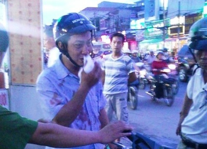 Tai xe taxi dam gay mui nguoi di xe may hinh anh