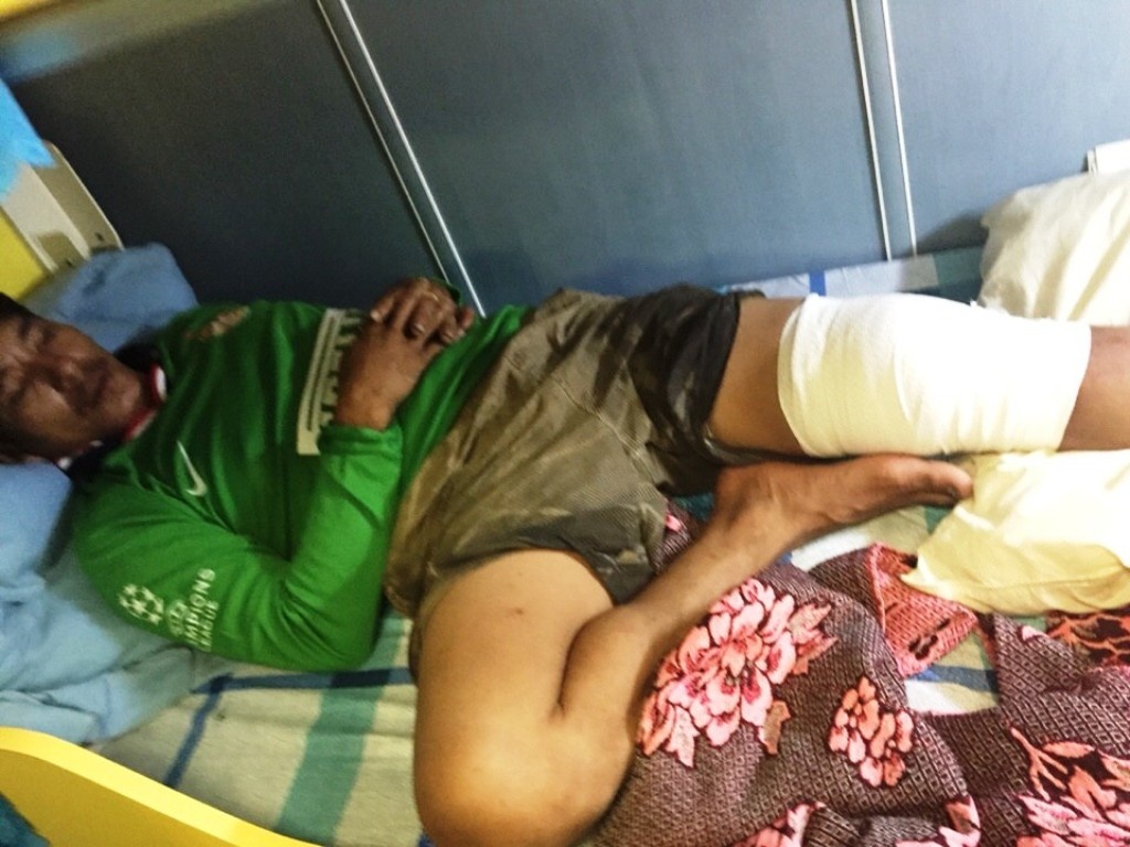 Anh Vinh bị gãy chân trong lúc xuống hầm cá cứu bạn.