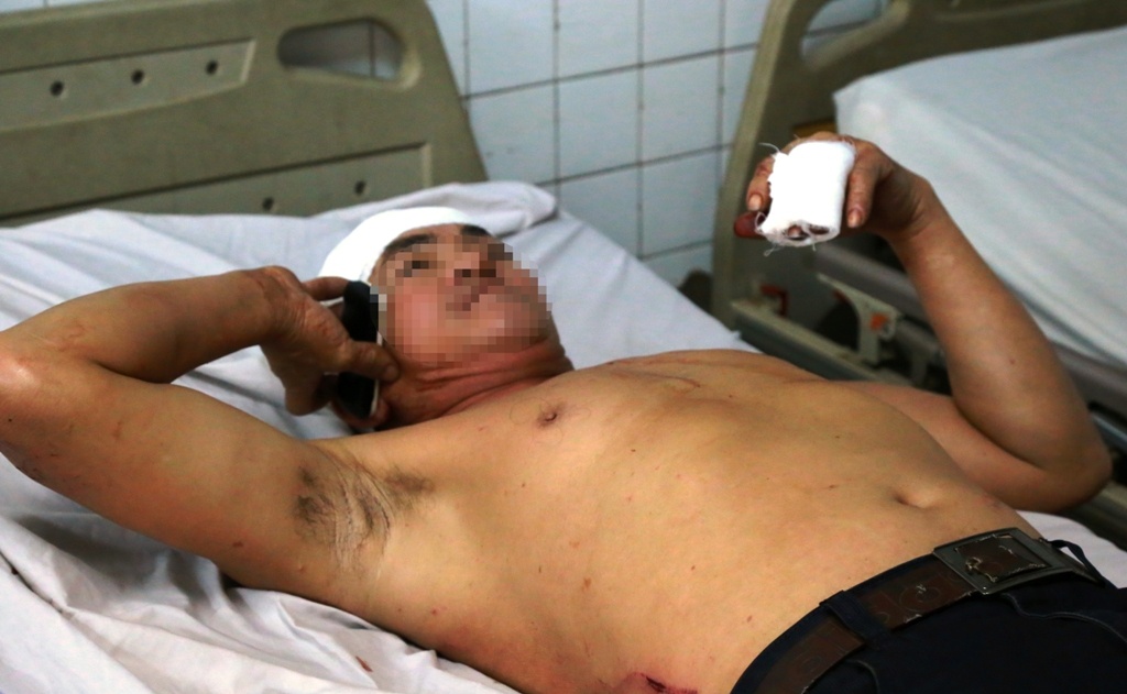 Một hành khách bị thương đang được điều trị tại bệnh viện.