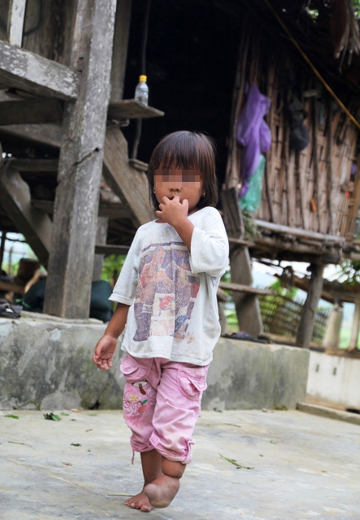 Những đứa trẻ tật nguyền, hệ quả của hôn nhân cận huyết, một vấn đề nan giải mà đến giờ chưa có lối thoát.