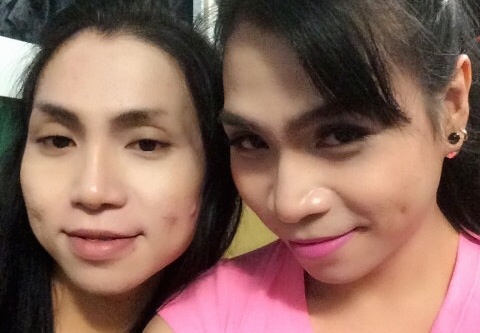 Di hat dam ma kiem tien phau thuat chuyen gioi hinh anh