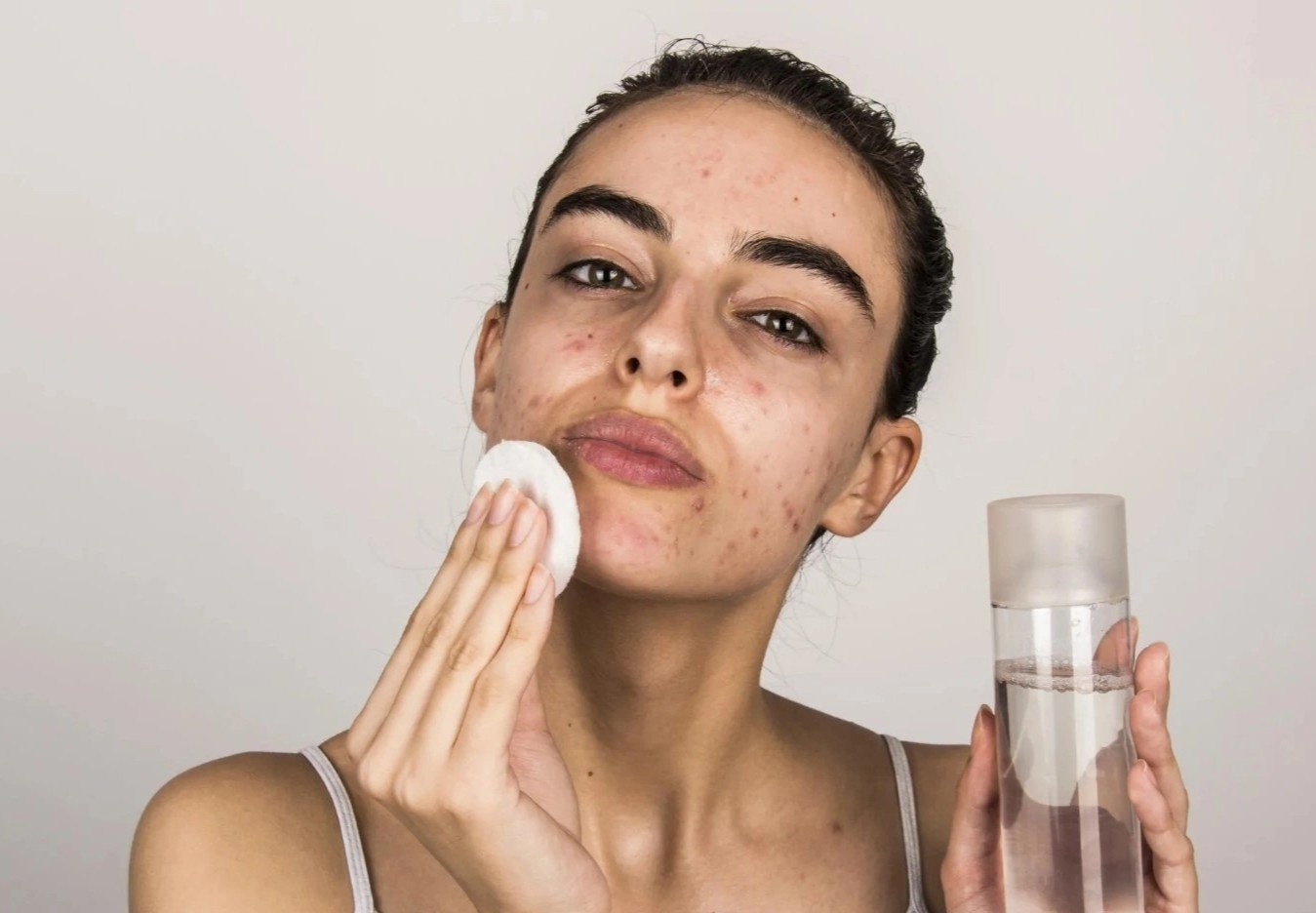 6 tinh huong 'cham day noi dau' cua nang da mun hinh anh