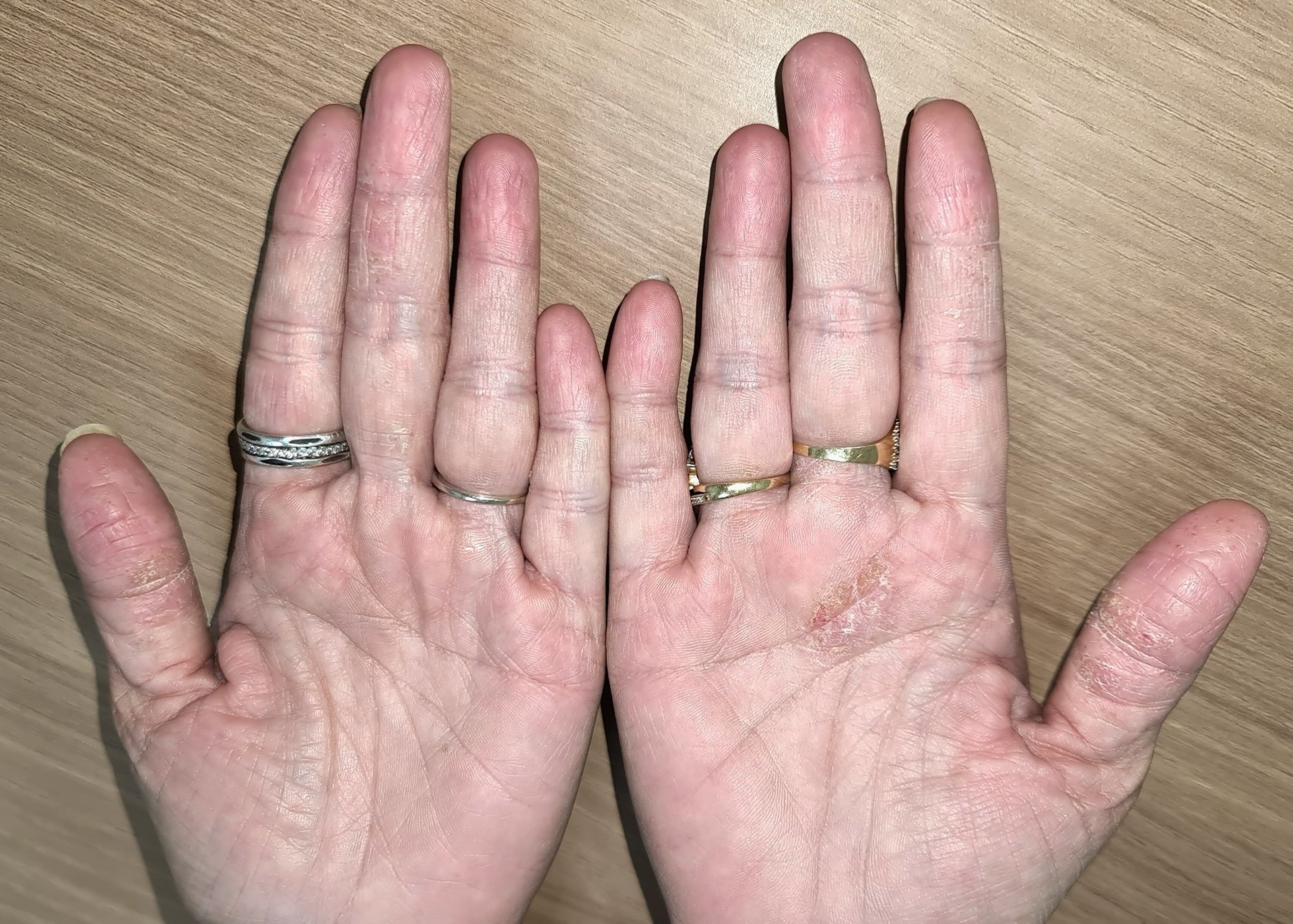 Cham to dia dai dang 5 nam do bia sach dam vao tay hinh anh