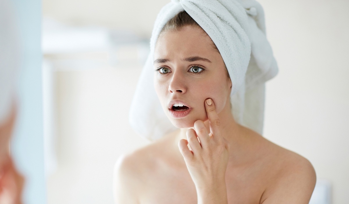 da mụn dưỡng sáng ảnh 3 da mun duong sang anh 3