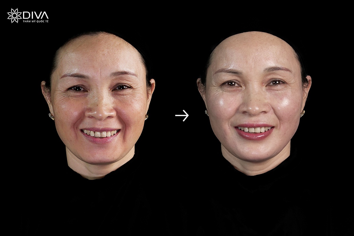 Tham my quoc te Diva anh 2