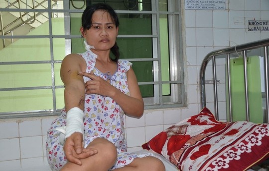 Phao hoa roi trung dau, 3 nguoi nhap vien hinh anh