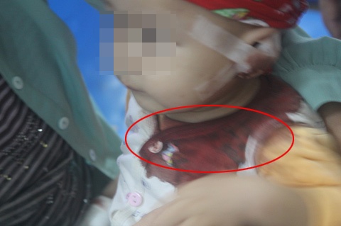 Su that ve man kich 'xin tien chua ung thu cho con' hinh anh