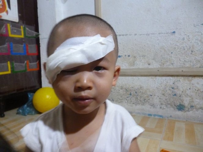 Vu nem da xe khach: Chau be chi con nhin duoc mot mat hinh anh