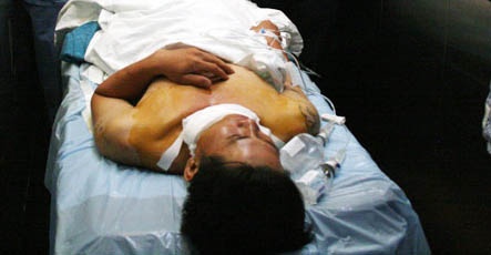 Mot nguoi chet do luoi cua sat gay vang trung co hinh anh