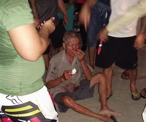 Ong cu 70 tuoi bi nam thanh nien hanh hung sau va cham hinh anh