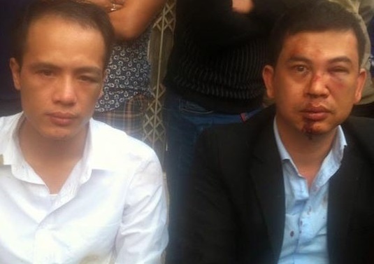 Cong an dieu tra vu hai luat su bi danh giua duong hinh anh