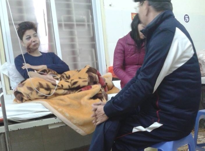 Thanh nien bi phao no vo quai ham truoc them nam moi hinh anh