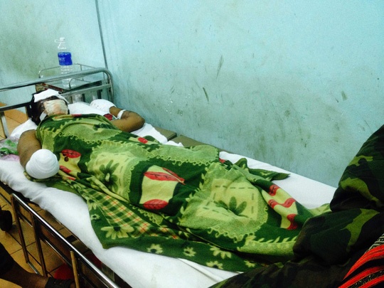 Cuoc trung min, 2 nguoi bi thuong nang hinh anh