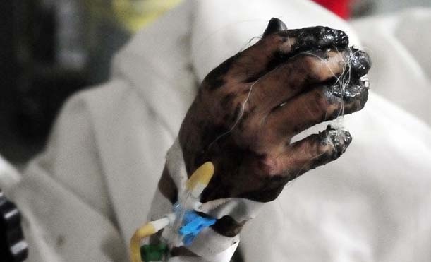 Giam dinh ADN hai nan nhan vu xe bon tong xe khach hinh anh