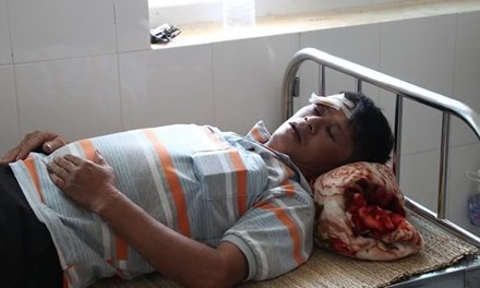 Lam tac danh trong thuong can bo bao ve rung hinh anh