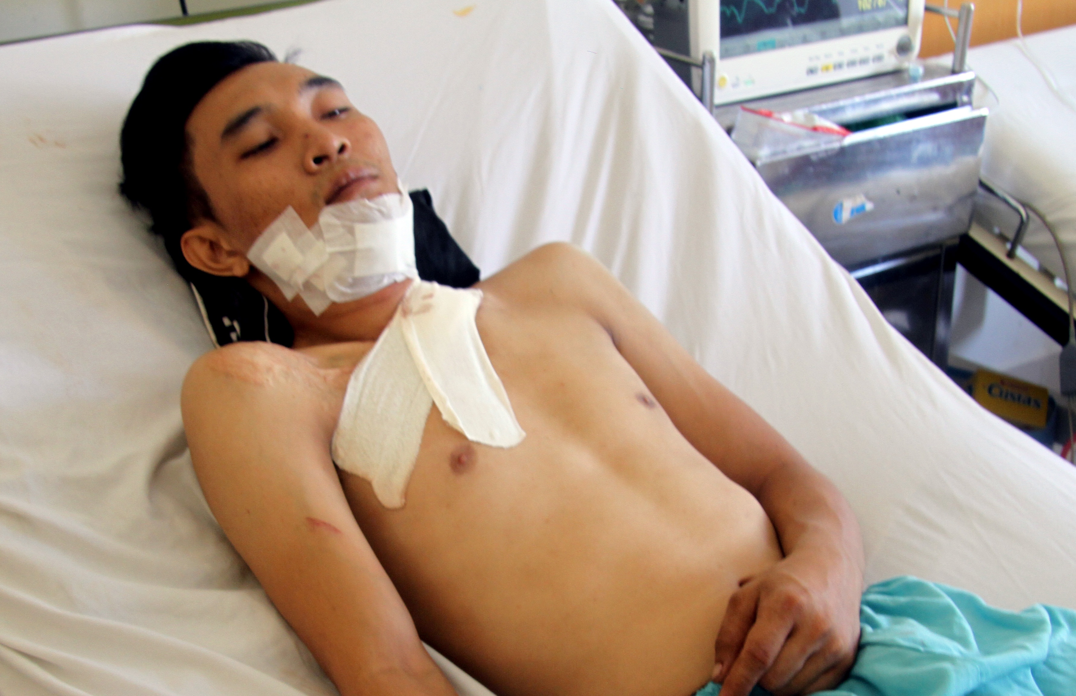Giang ho ban 3 phat sung vao nguoi thanh nien hinh anh