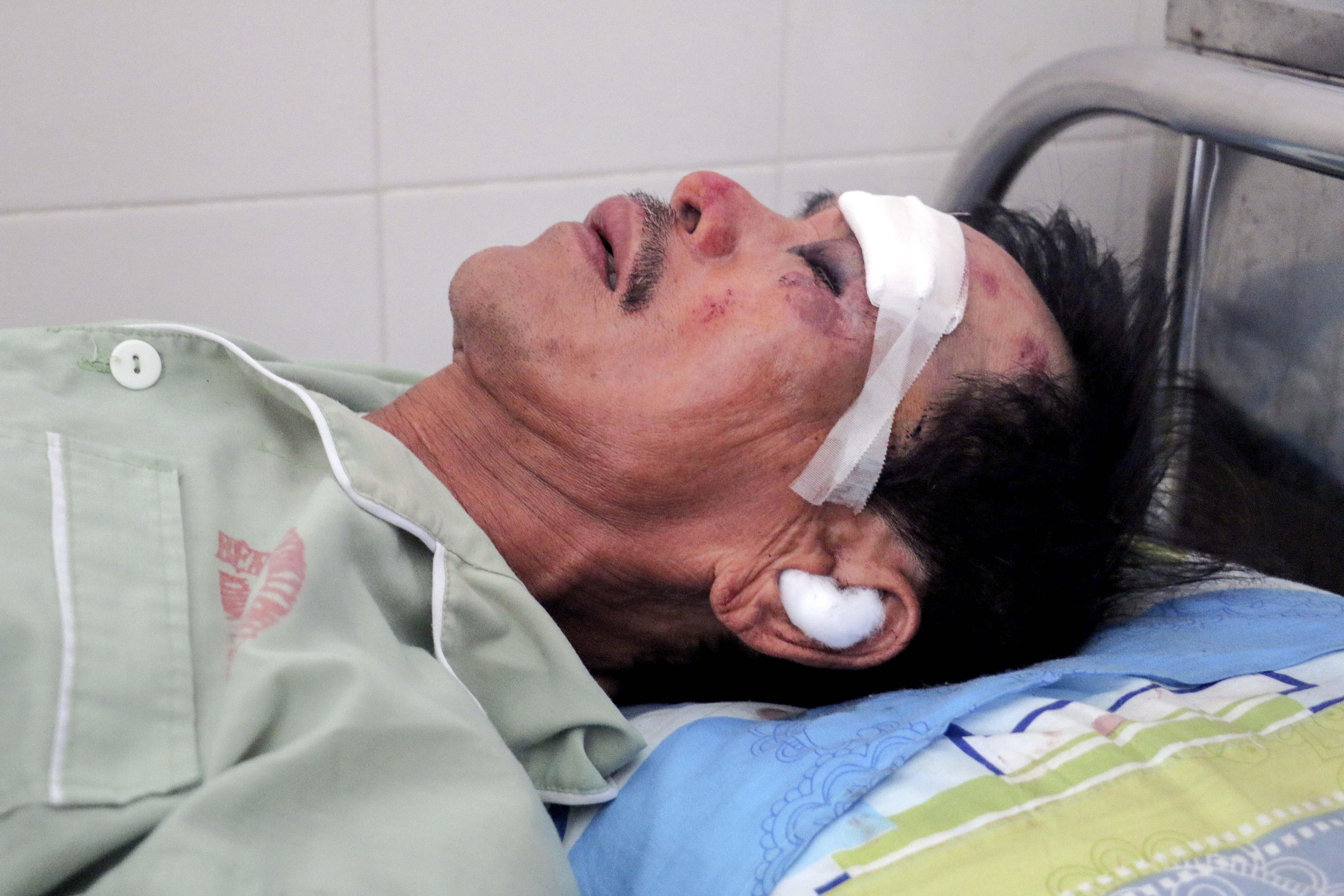 Máy bay quân sự rơi, một phi công tử nạn, một người dân bị thương ảnh 2 May bay quan su roi, mot phi cong tu nan, mot nguoi dan bi thuong anh 2