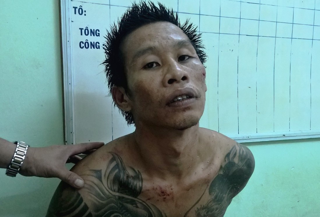 Ten trom xam tro tang tru nhieu do lot phu nu hinh anh