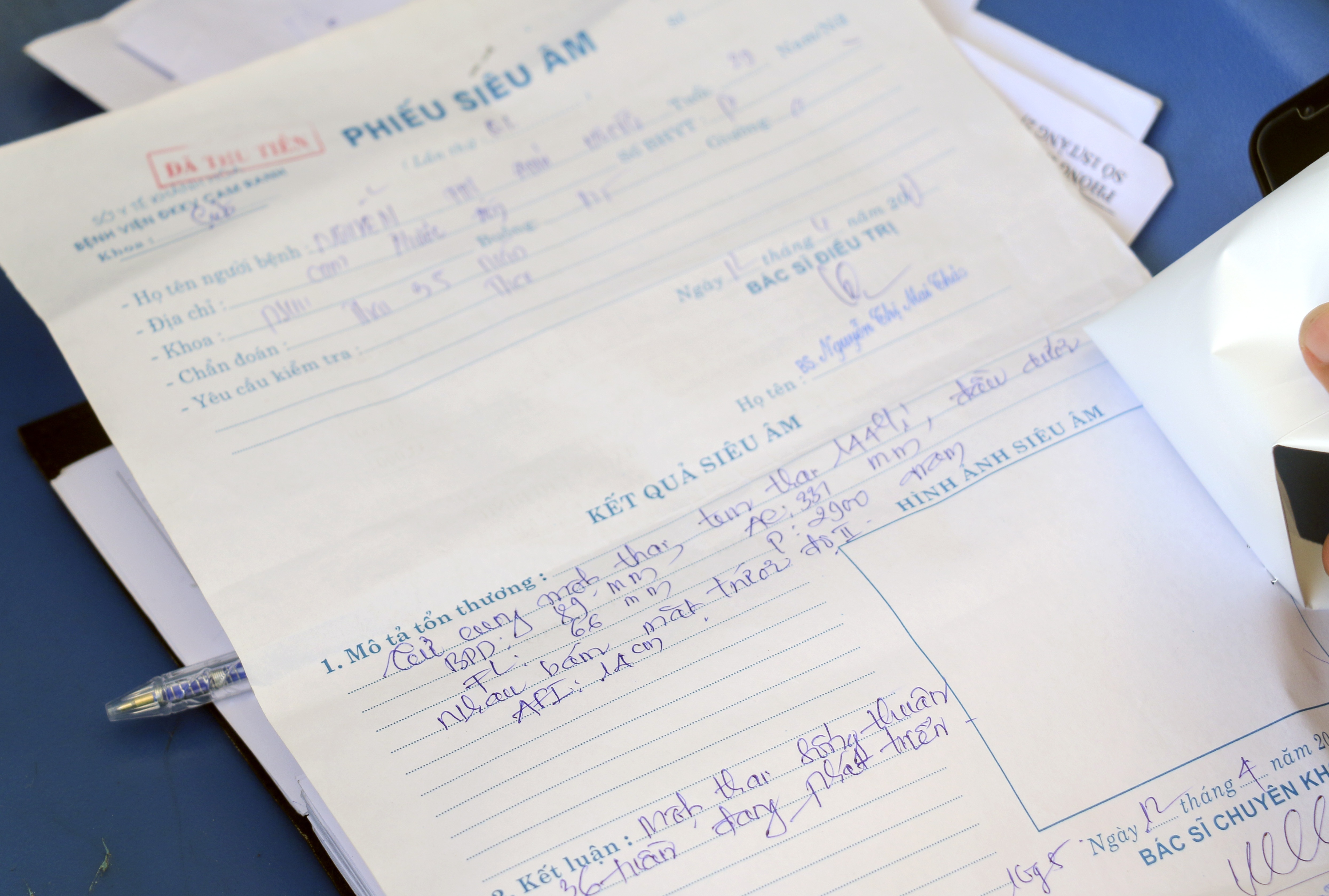 Thai nhi tu vong bat thuong anh 2