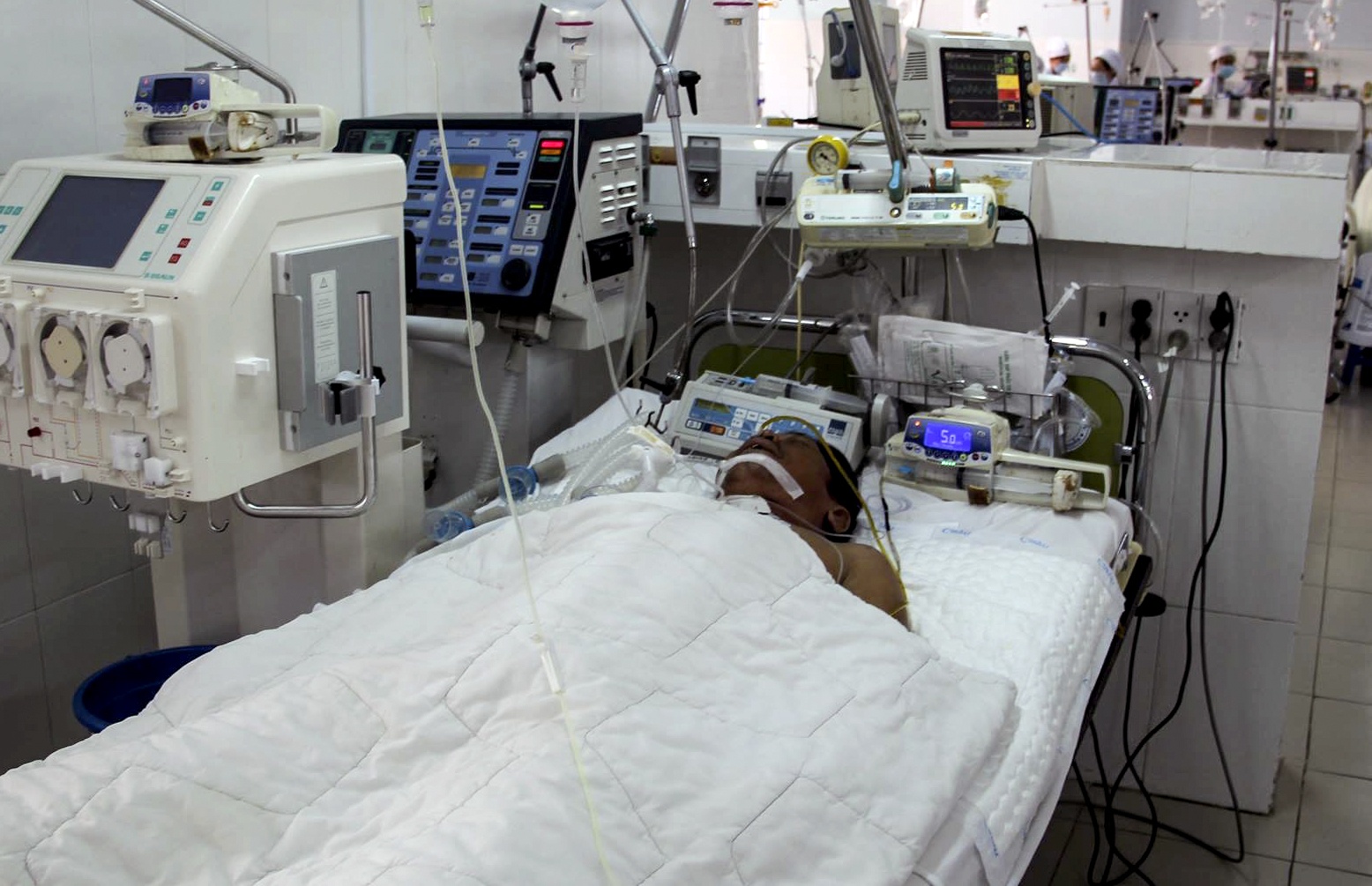 Nguoi dan ong 63 tuoi bi ngung tim, chet nao do ong dot hinh anh