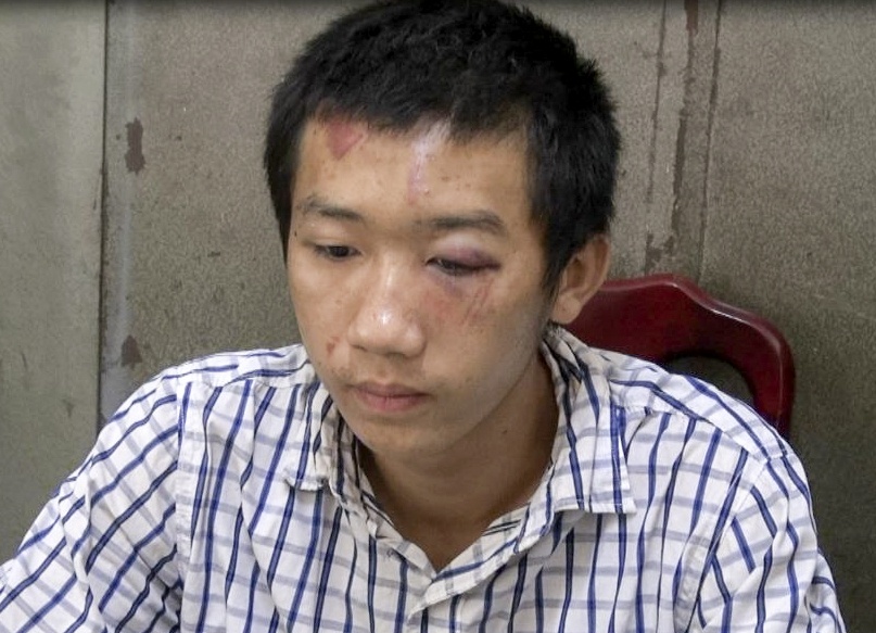 Vay bat 9X giat tui cua du khach nguoi Phap hinh anh