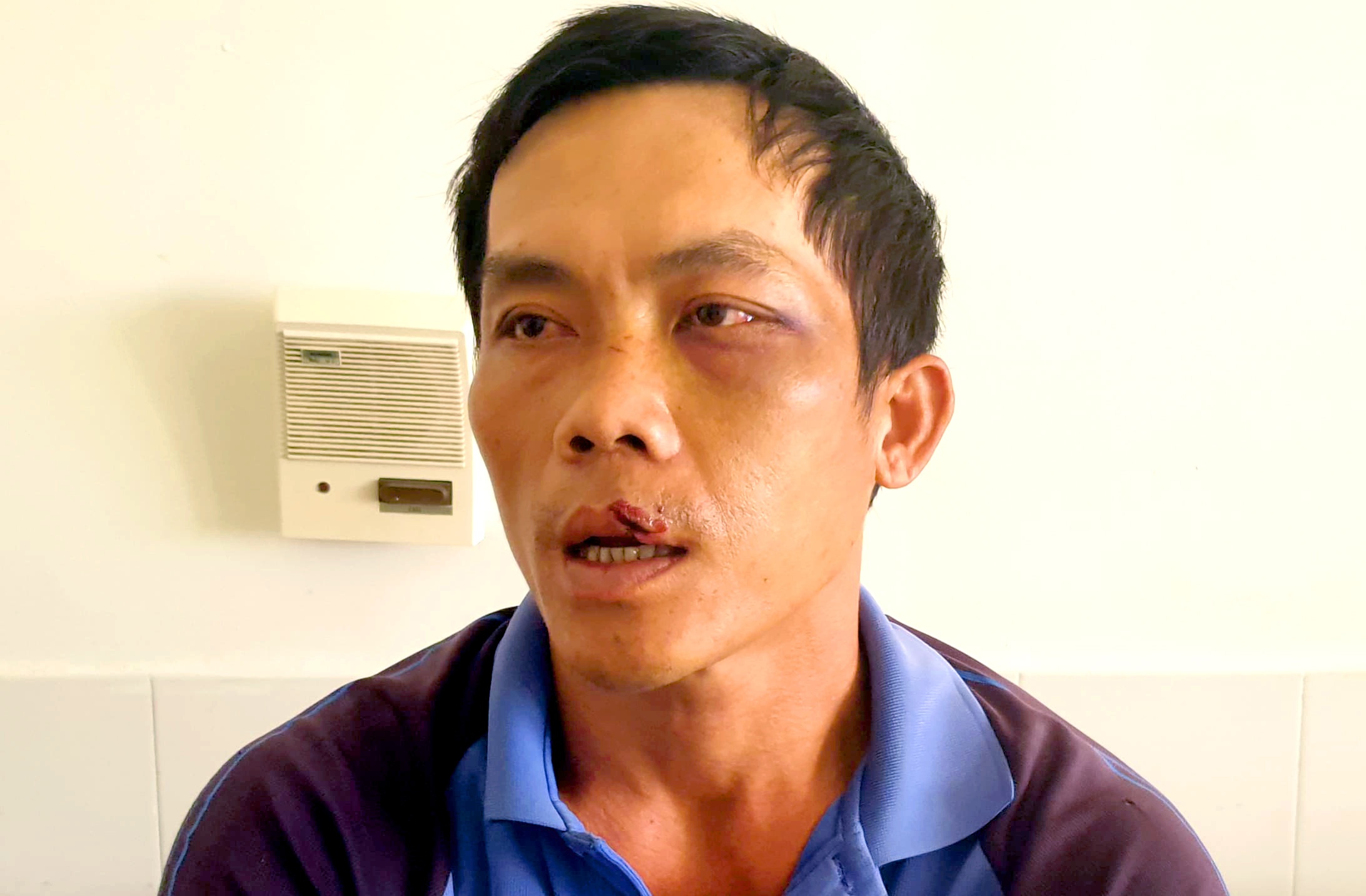 Nan nhan bi troi va phoi nang tren xe ban tai nhap vien cap cuu hinh anh