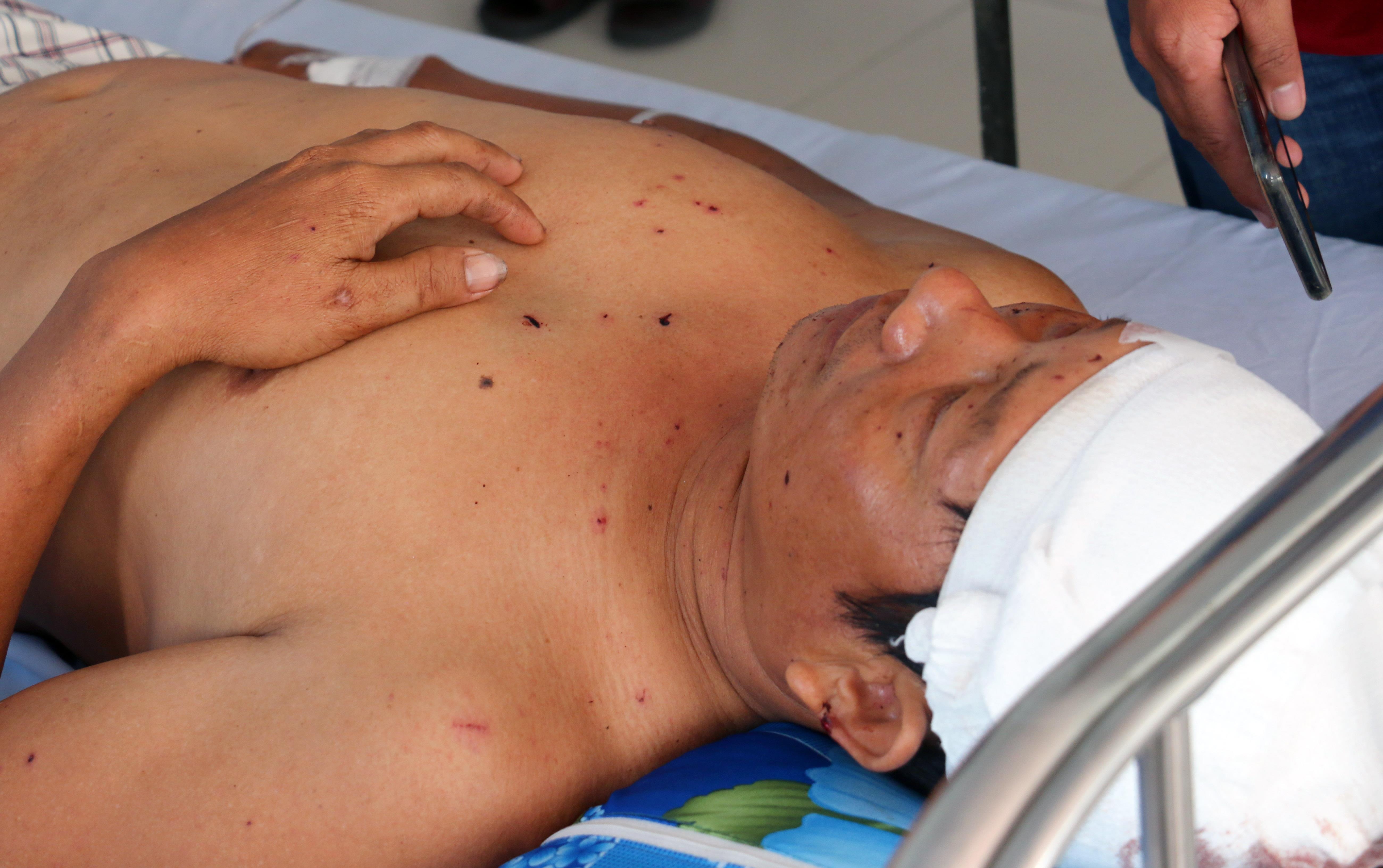 Cong nhan ke phut bi hat vang khoi lan trai sau tieng no lon hinh anh