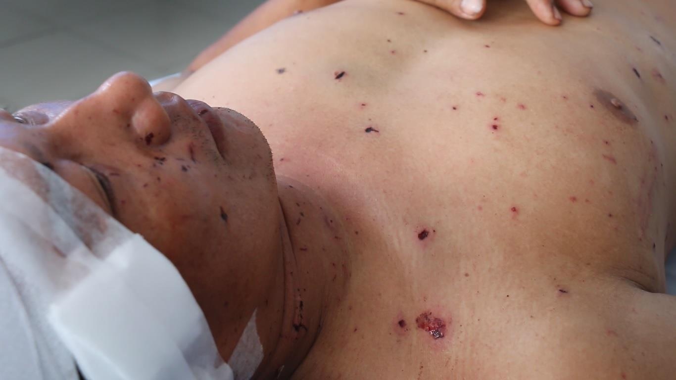 Phut kinh hoang sau tieng no vang troi o du an KN Paradise hinh anh