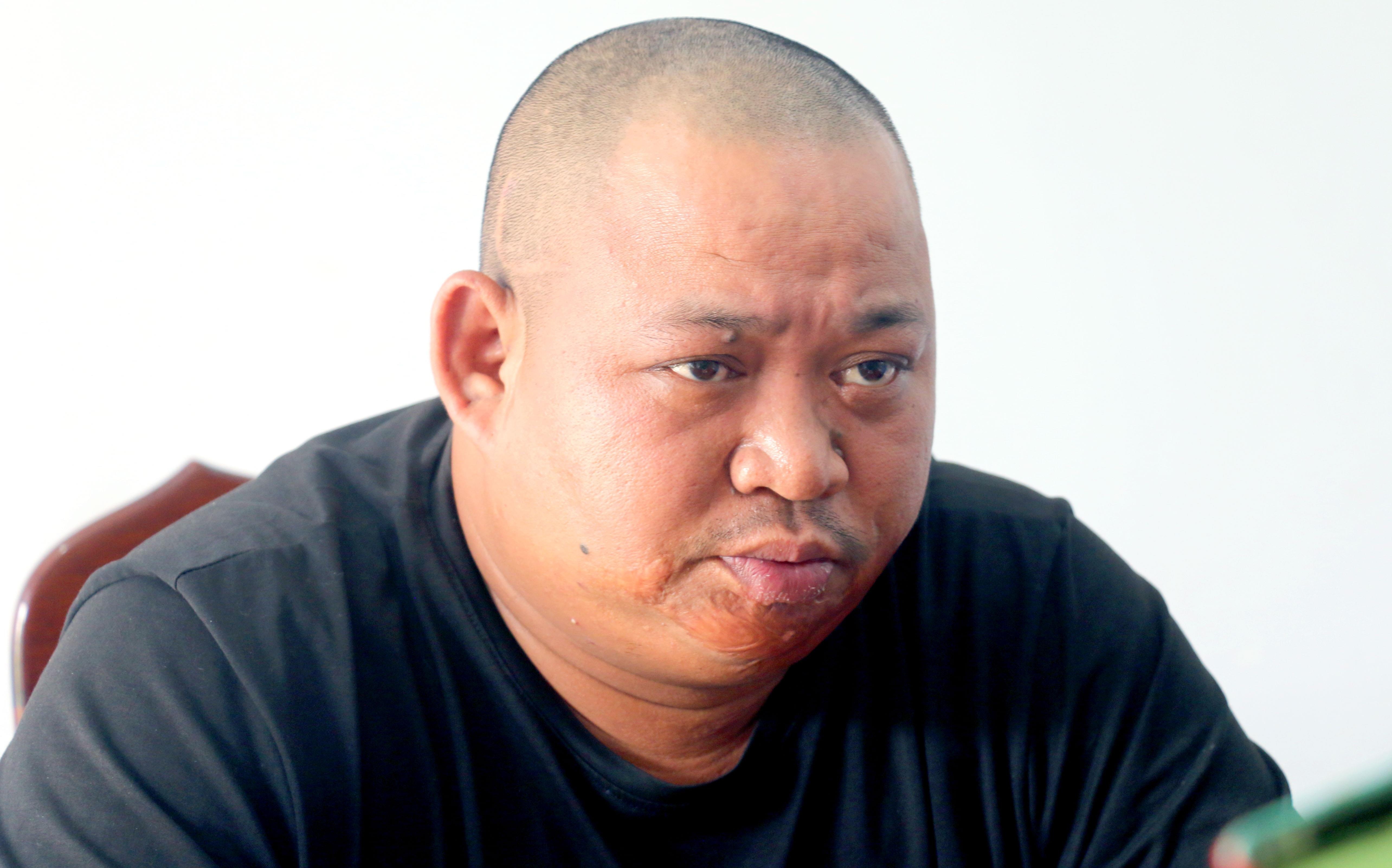 Ban guc doi thu do canh tranh trong khai thac lam san hinh anh