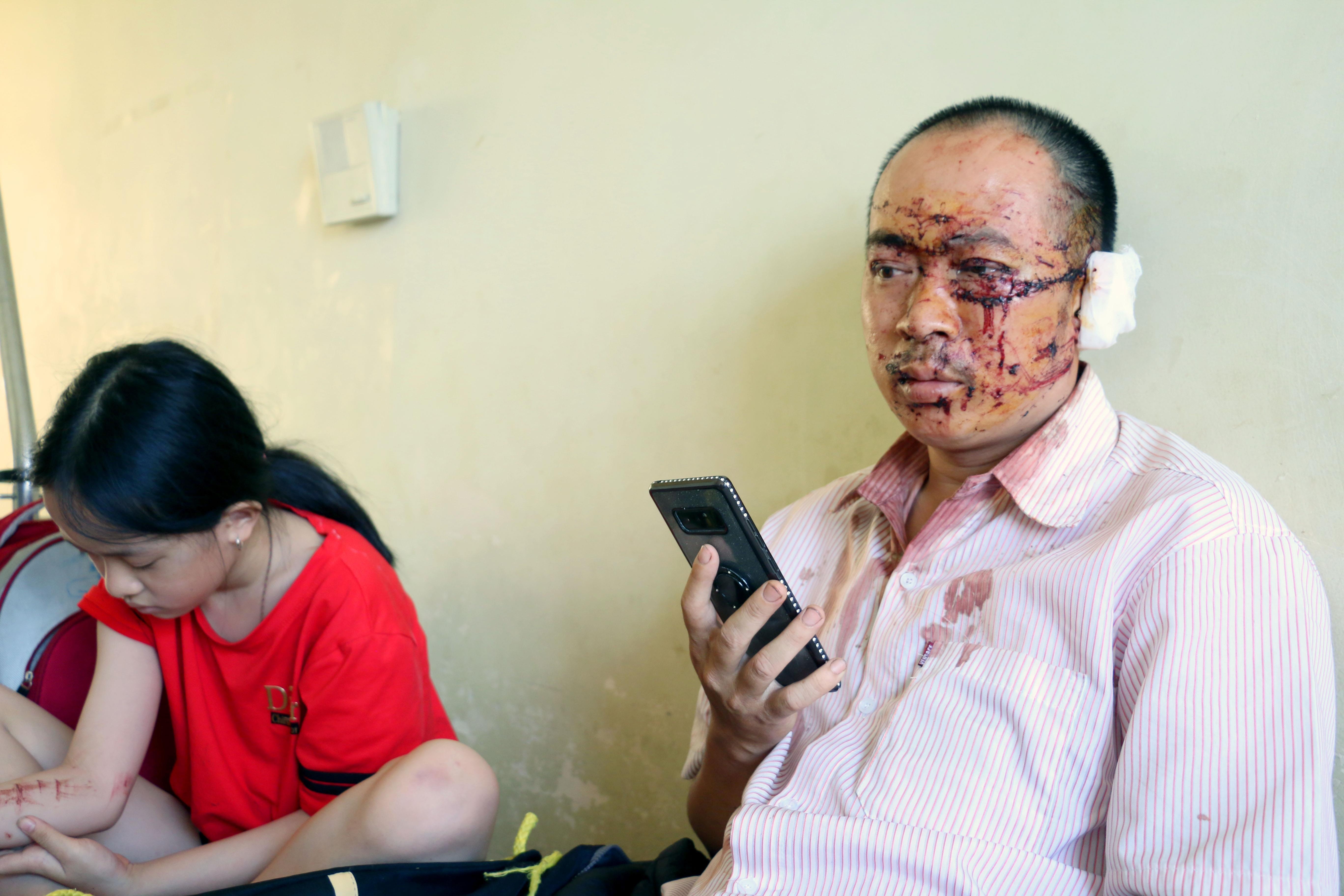 Xe khach tong nhau o Khanh Hoa anh 1