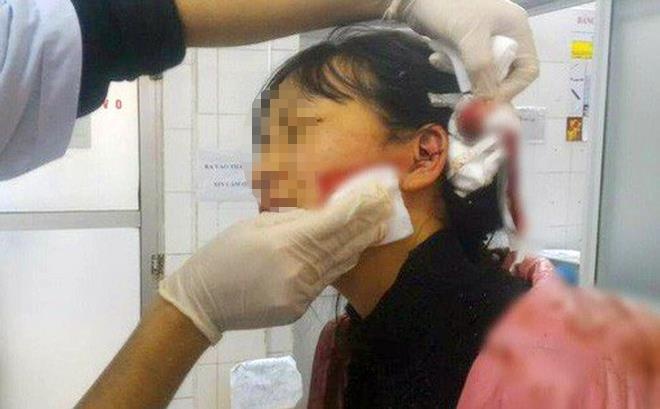 10X rach mat nu sinh truong chuyen trong nha ve sinh hinh anh