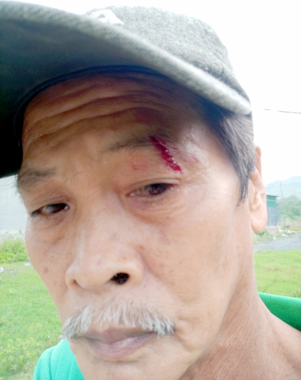 Ban nguoi o Khanh Hoa anh 1