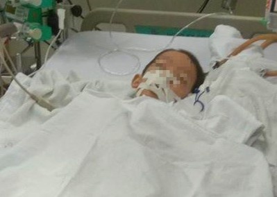 Be trai 7 tuoi nguy kich sau ca mo lay dinh nep o tay hinh anh