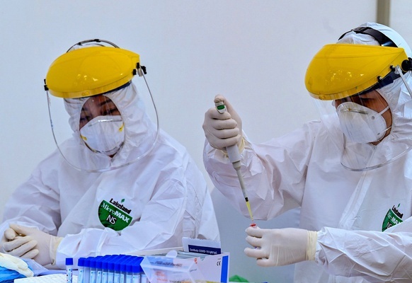 Viet Nam gui mau vaccine ngua Covid-19 sang My thu nghiem hinh anh