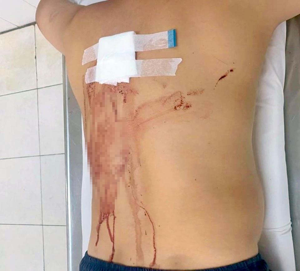 Dùng súng bắn người ở Khánh Hòa ảnh 1 Dung sung ban nguoi o Khanh Hoa anh 1