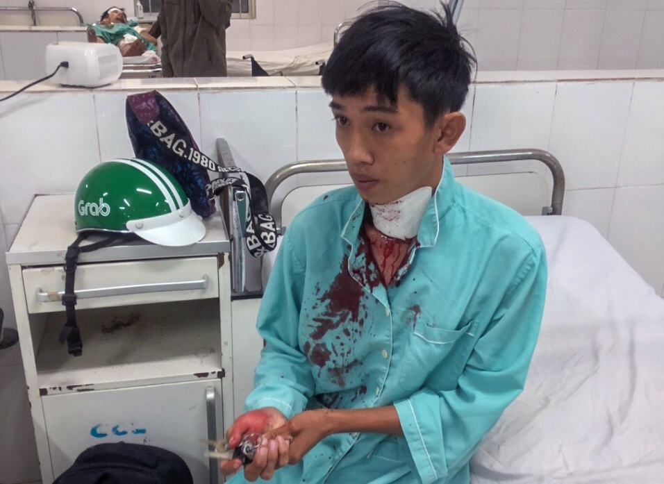 Tai xe xe om ke phut bi cuop cua co hinh anh