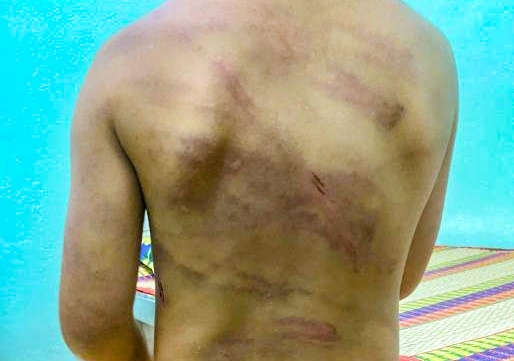 Yeu cau xu nghiem vu cha duong bao hanh be gai 7 tuoi hinh anh